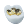 Zirconia crown ġ